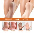 thumbnail image 5 of Spray exfoliante para pies con aceite de naranja, para piel muerta, hidratante y nutritivo, para piel muerta y callos, 100 ml. Spray exfoliante para el cuidado de los pies., 5 of 5