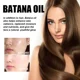 thumbnail image 5 of Aceite Esencial de queratina para cabello seco y dañado, mascarilla para el cabello, aceite complejo de plantas secas, productos para el cuidado, 100% puro, Batana, 5 of 5