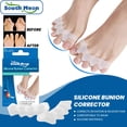 thumbnail image 1 of DPTALR Silicone Thumb Cyst Corrector, Used To Repair And Correct Thumb Cyst Inflammation, And Some Pain (1 Pair), 1 of 9