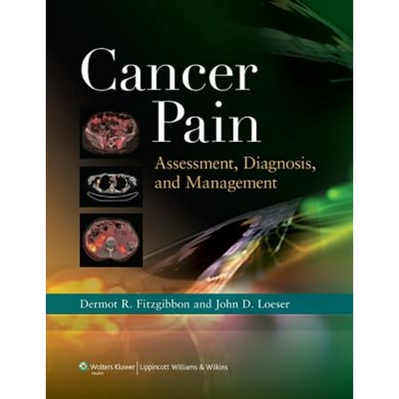 UPC: 9781608310890 | Cancer Pain: Assessment  Diagnosis  and Management (Hardcover)
