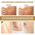 thumbnail image 3 of WIFKLSIIPG Skin Invisibles Concealer Sticker Tattoo Concealer Sticker Ultra Thin Patch Skin Tone Sticker Scar Tattoo Acne Seal Covering Sticker Waterproof, 3 of 7