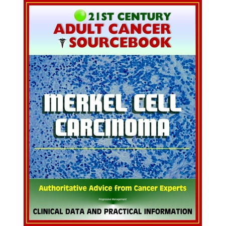 21st Century Adult Cancer Sourcebook: Merkel Cell Carcinoma (MCC) - Clinical Data for Patients, Families, and Physicians -
