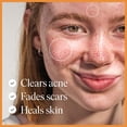 thumbnail image 2 of Serum 47 hidratante facial para eliminar el acné y las cicatrices, 30 ml, 2 of 8