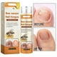 thumbnail image 4 of natural nail care solution for ingrown toenails, 4 of 5