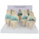 thumbnail image 1 of Knee Kit Osteoarthritis Anatomy Model with Educational Key Card 4 Stage Knee Model Orthopedic Teaching Aids, 1 of 5