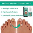 thumbnail image 5 of Anti Nail-Fungus Liquid for Grey Nails Uneven Colors Nail, Quick Absorption Nail Strengthening Cream, Nails Care Supplies, 5 of 5