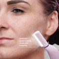 thumbnail image 4 of Sistema de dermaplanamiento Michael Todd Beauty Sonicsmooth Pro+, 4 of 8