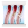 thumbnail image 2 of Manikin Body Plastic Ldl Model Plastic Teaching Model Dynamic Ldl Model Blood Vessel Anatomy Model Artery Vein Model, 2 of 3