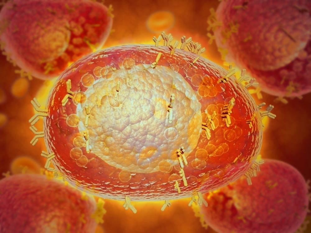 Microscopic View Of A Mast Cell Found In Connective Tissue That 