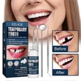 thumbnail image 3 of Tooth Repair Kit, Temporary Teeth Filling Repair Kit, Fixing The Missing And Broken Tooth Replacements Restore Your Smile, 3 of 5