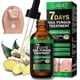 thumbnail image 2 of Nail Fungus Treatment, Ginger Nail Fungus Treatment, 7 Days Nail Fungus Treatment for Toenail, 2 of 5