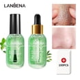 thumbnail image 1 of 2PCS LANBENA Blackhead Remover Set Pore Serum Set Skincare 17ml+17ml, 1 of 5