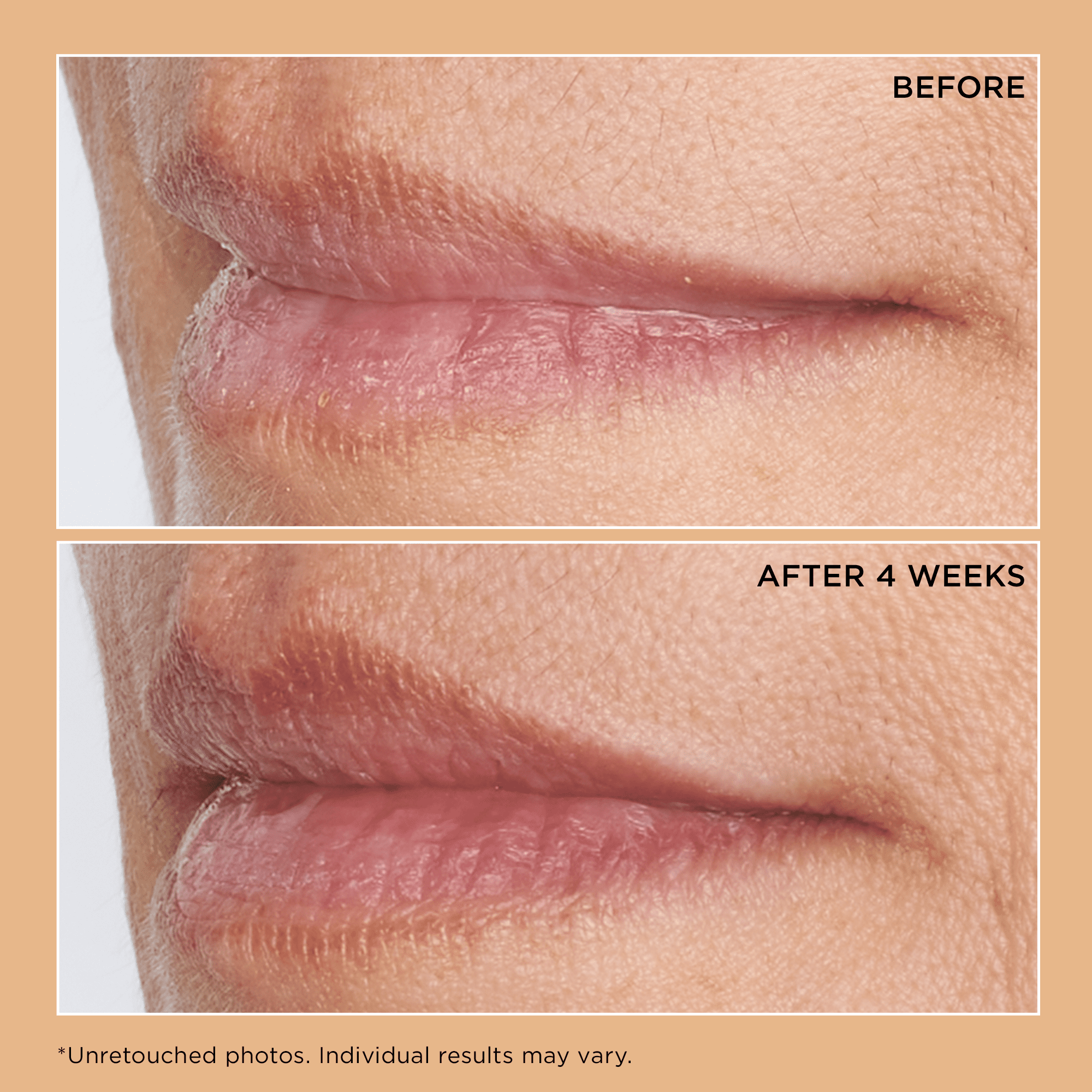Perricone MD No Makeup Lip Oil, Lychee
