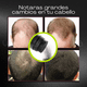 thumbnail image 3 of Fibras Capilares Naturales 25g Disimular Calvicie Cabello, 3 of 8