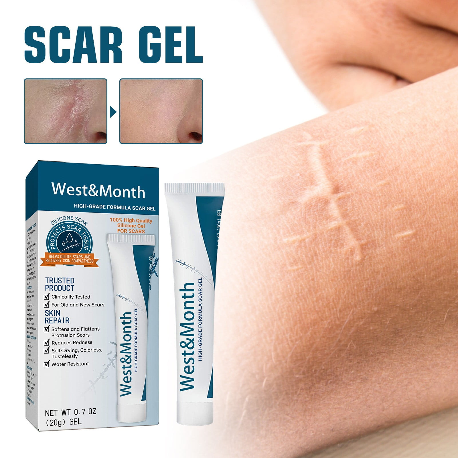 Buy 2 get 1 freeFast Remove Removal Gel Advanced Scar Gel Old Stretch