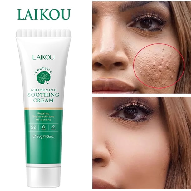 LAIKOU-Crema de cuidado facial coreana, crema blanca de caracol, hidratante, antienvejecimiento, antiarrugas, de día"one" Fivean LED