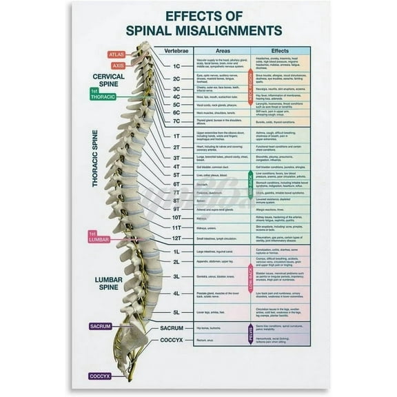 Vertebral Subluxation Poster Spinal Nerve Function Chart Poster (2) Canvas Painting Wall Art Poster for Bedroom Living Room Decor