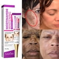 thumbnail image 3 of Nicotinamida crema blanqueadora para pecas, elimina el Melasma, manchas oscuras, acné, ilumina la melanina, ilumina el tono de la piel, cuidado de la piel facial, 3 of 4