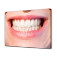 thumbnail image 1 of Póster de lienzo con dientes blancos para mujer, decoración de dormitorio, paisaje deportivo, decoración de oficina, regalo, estilo marco, 12 x 18 pulgadas (30 x 45 cm), 1 of 8