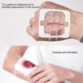 thumbnail image 5 of Zipper Band-Aid for Painless Wound Closure - Suture-Free Dressing Patches, Zip Suture Reducer, Band Aid for Quick Healing, 5 of 5