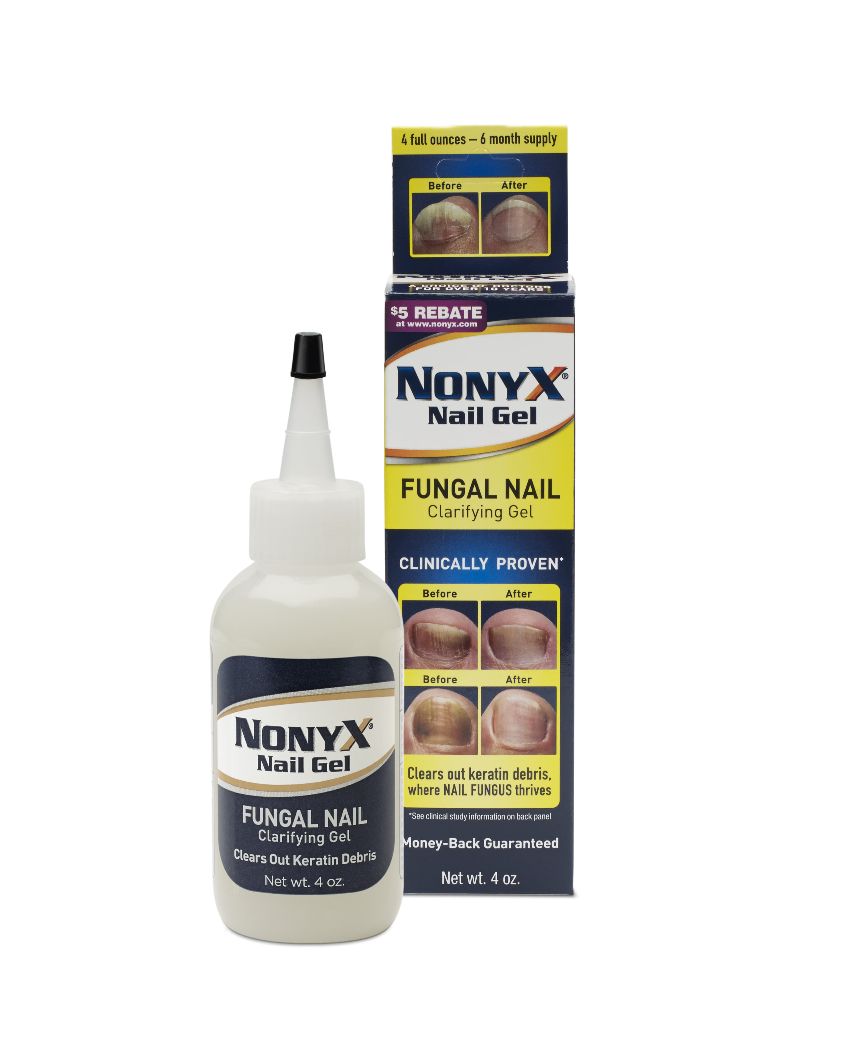 nonyx-fungal-nail-clarifying-gel-4-oz-walmart-walmart