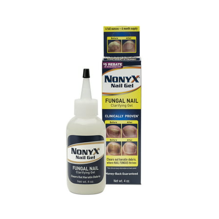 NonyX Nail Gel with Foot Soaking Tray (Best Foot Bath For Toenail Fungus)