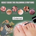 thumbnail image 4 of 15ml Fungal Nail Treatment Liquid Highly Effective Kills Toe Nail Fungus 2pcs, 4 of 5