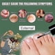 thumbnail image 4 of 15ml Fungal Nail Treatment Liquid Highly Effective Kills Toe Nail Fungus 2pcs, 4 of 5