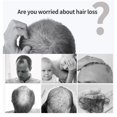 thumbnail image 4 of Suero Para El Crecimiento Del Cabello, 2 Unidades De 30 Ml, Repara Las Cutículas, El Líquido Para El Cuidado Del Cabello Mantiene La Salud Del Cuero Cabelludo Para El Cuidado Del, 4 of 7