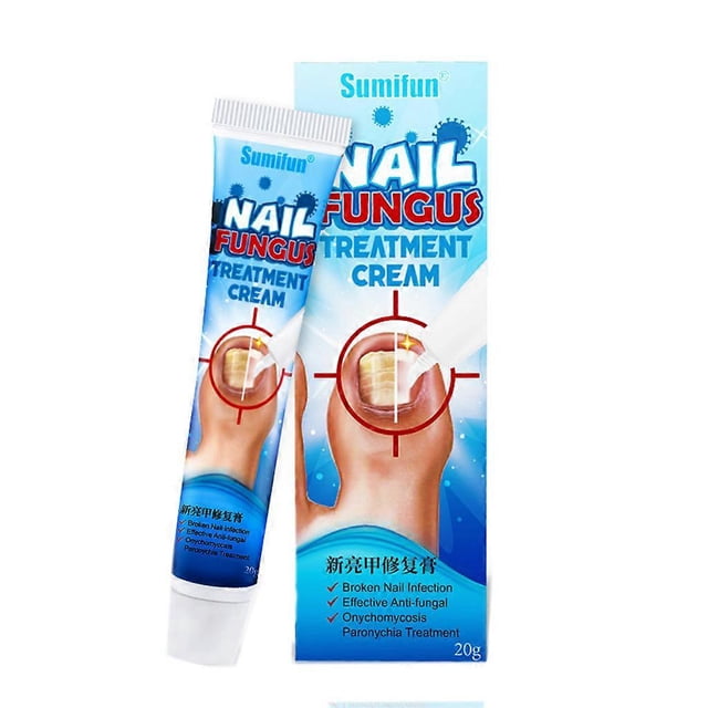 Crema china para el tratamiento de hongos en las uñas de los pies, a base de hierbas, 20 g, ungüento reparador antibacteriano y antifúngico para onicomicosis y paroniquia