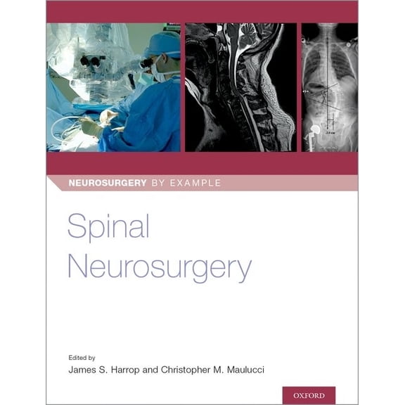 Neurosurgery by Example Spinal Neurosurgery, (Paperback)