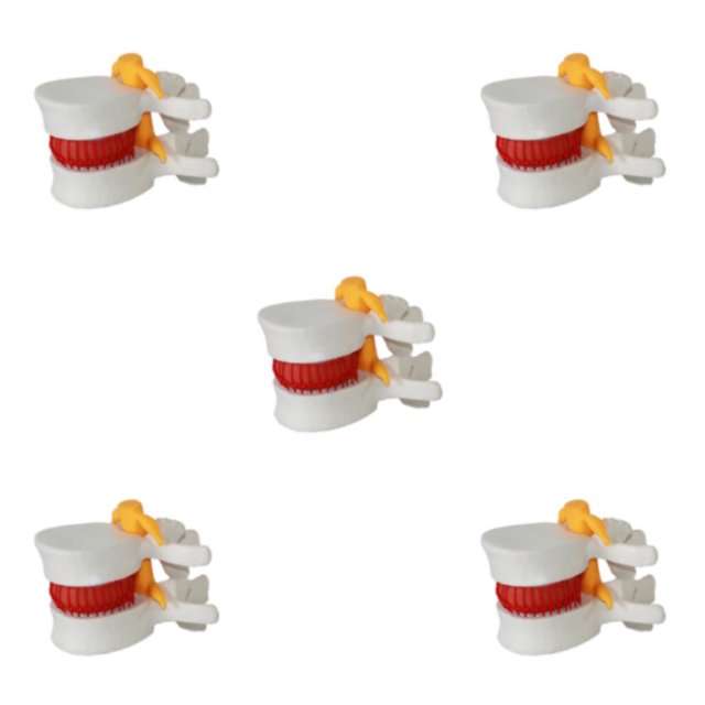 Ruiboury Wide Application Lumbar Vertebrae Model For Props Teaching Durable white 5Set