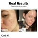 thumbnail image 4 of Sérum facial COSRX con niacinamida al 15% que minimiza los poros, 20 ml, 4 of 8