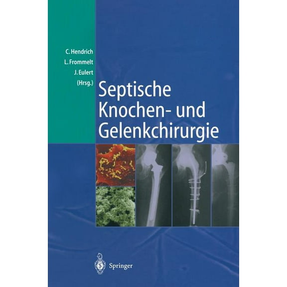 Septische Knochen-Und Gelenkchirurgie, (Paperback)