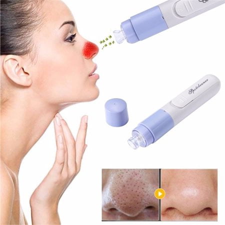 Electric Facial Pore Cleanser Cleaner,WALFRONT Electric Facial Pore Cleanser Cleaner Kit Face Blackhead Acne Suction Remover (Best Pore Remover Product)