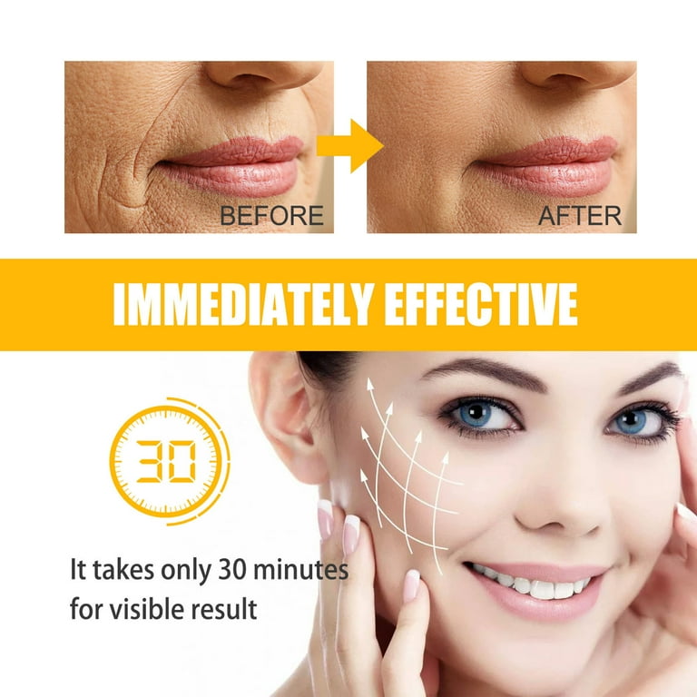 Gzwccvsn Smile Line Patches - 5 Pairs - Anti-Wrinkle Facial Gzwccvsn Smile Line Patches - 5 Pairs - Anti-Wrinkle Facial