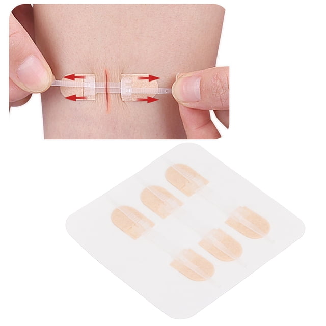 Tiritas para Cierre de Heridas Reparación de Heridas sin Coser Parches de Cierre de Heridas con Cremallera de 3 Correas Suturas Elásticas Transpirables sin Costuras con ANGGREK Otros