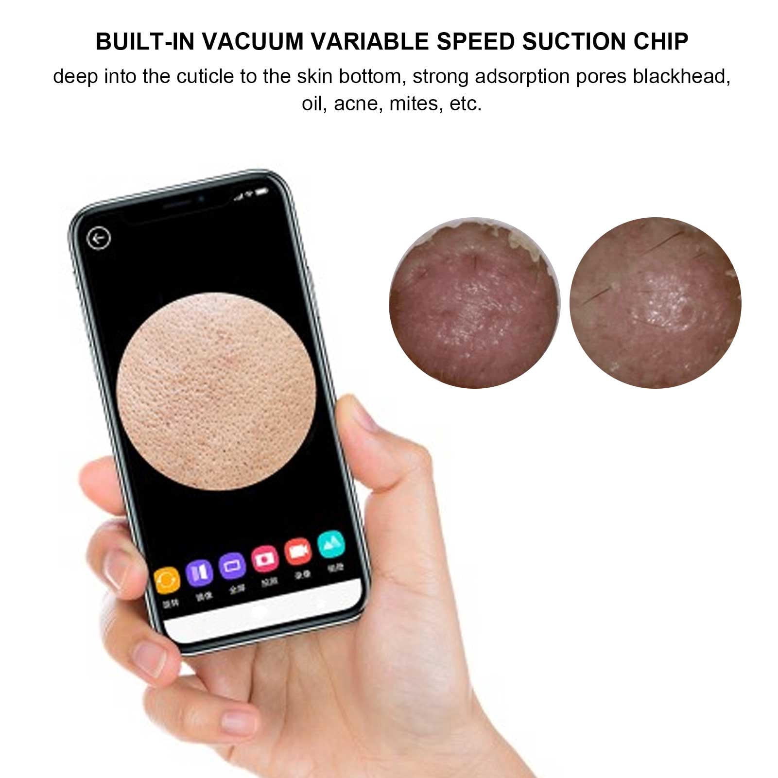 Yajisi Visual Blackhead Remover Vacuum Pore Cleaner with Hot Compress 5 Suction Levels 6 Replaceable Probes for Facial Deep Cleaning 7.87 x 5.51 x 1.97 in