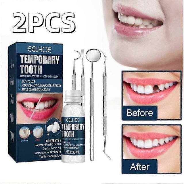 kit de reparación temporal de dientes de 2 piezas que repara dientes rotos y rellena espacios, no tóxico — paquete azul con frasco NET:30ML y cuatro herramientas dentales metálicas en vista frontal; recuadros antes/después muestran diente frontal faltante y luego rellenado; indicado para reparaciones temporales inmediatas y uso en fiestas o disfraces.
