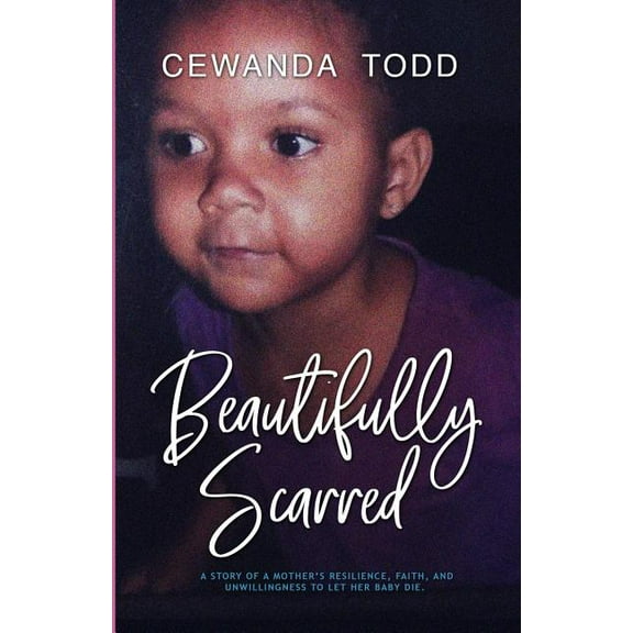 Beautifully Scarred: A Story of a Mother's Resilience, Faith, and Unwillingness to Let Her Baby Die., (Paperback)