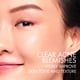 thumbnail image 5 of Crema hidratante Vichy Normaderm Acné Control 2% Ácido Salicílico, 5 of 8