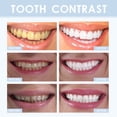 thumbnail image 2 of Tiras de limpieza de dientes 7 Uds tiras de limpieza de dientes adhesivos antideslizantes para dientes sin peróxido para blanquear los dientes, 2 of 5