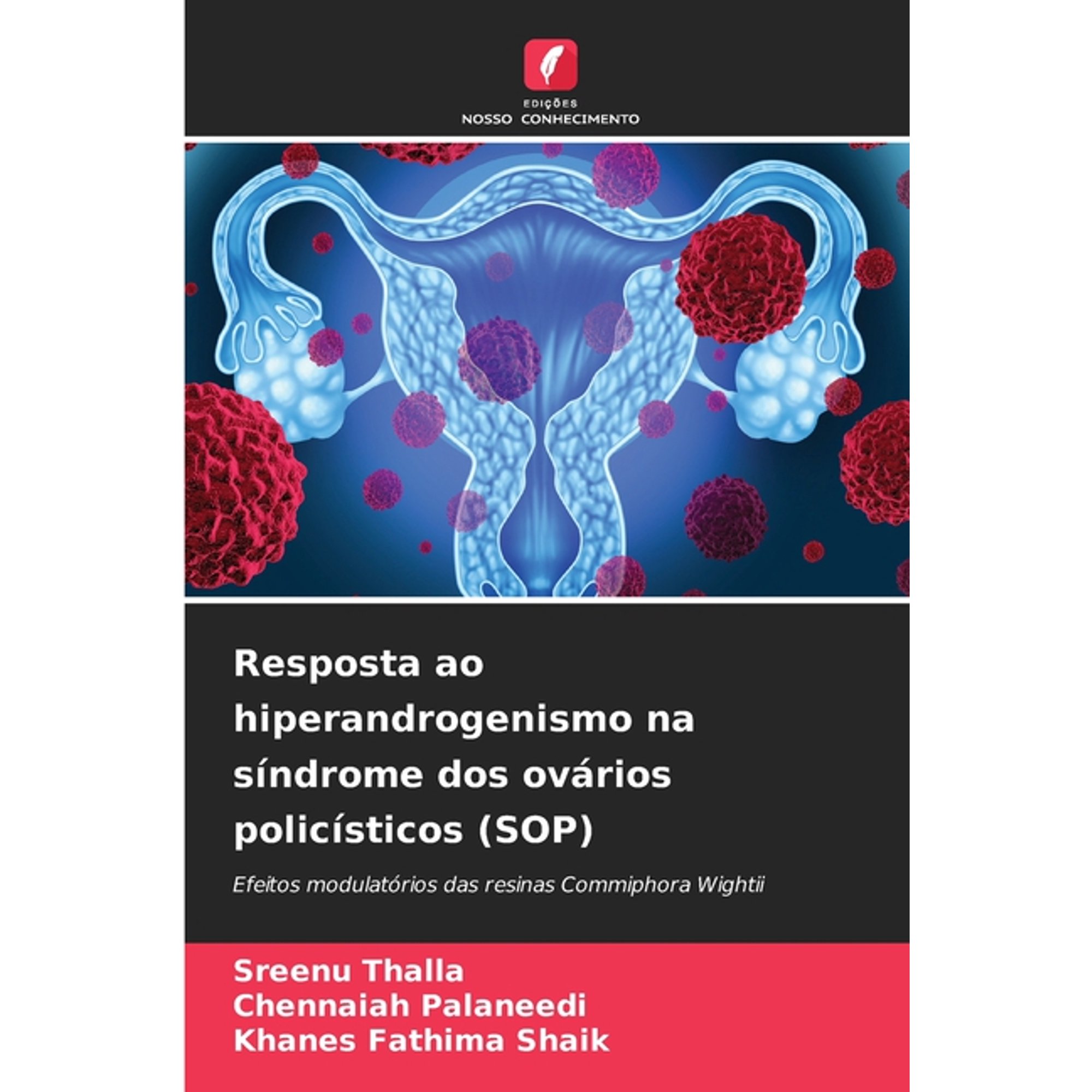 Resposta ao hiperandrogenismo na síndrome dos ovários policísticos (SOP) (Paperback)