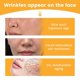 thumbnail image 3 of Nasal fold firming patch dilutes fine lines, lifts and firms facial skin, 3 of 5