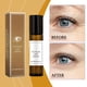 thumbnail image 5 of Fiudx Ofertas y liquidaciones Suero rodillo para ojos 10 ml, 5 of 7