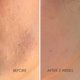 thumbnail image 5 of VQM PLUINO Skin Care Booster Capsule Serum facial Esencia hidratante Pantenol y niacinamida. Hidratante facial para pieles sensibles y con acné Cuidado de la piel coreano 25 g/0,88 fl.oz, 5 of 5