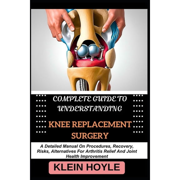 Complete Guide to Understanding Knee Replacement Surgery: A Detailed Manual On Procedures, Recovery, Risks, Alternatives, (Paperback)
