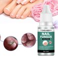 thumbnail image 3 of 10ml Fúngico Bactericida Natural Multiusos para El Cuidado Los Pies, 3 of 8