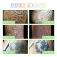 thumbnail image 5 of Dreparja Under $5 Tattoos Brightening Aftercare Use This Cream To The Color Of The Tattoos Repair Cream Soothes And Repair Skin Safe For All Skin 2pc, 5 of 9