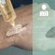 thumbnail image 5 of Scar and scar mark removal ointment cream, 5 of 5